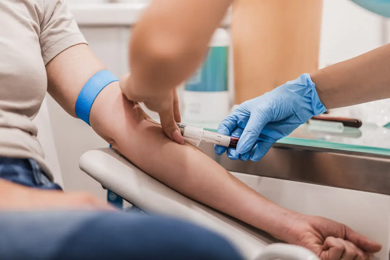 Close-up of a medical professional preparing a blood sample at Evolve HRT & Wellness in The Woodlands, TX, representing their lab work services.
